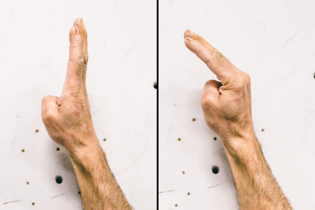 Es aconsejable calentar los músculos lumbricales de la mano antes de la escalada de romos.